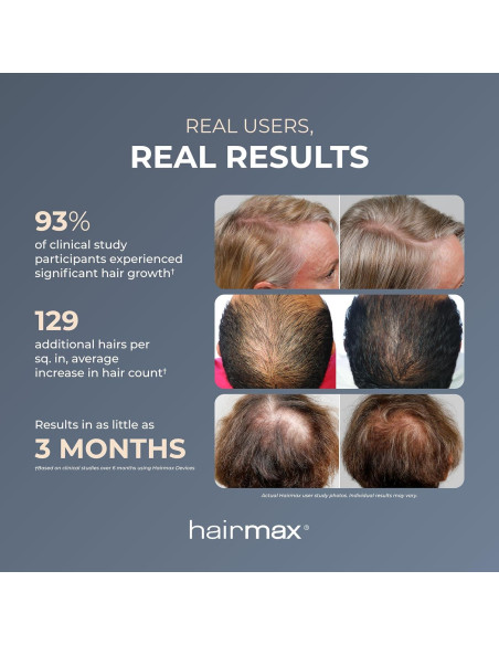 Hairmax Ultima 12 LaserComb - Tratamiento Capilar Inalámbrico