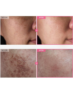 Crema Arbutina 7% + Ácido Tranexámico 4% 50ml Cuidado Piel 2