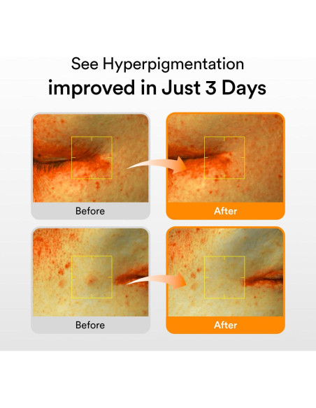 Suero Abib Glutathiosome 50ml - Iluminador para Manchas Oscuras