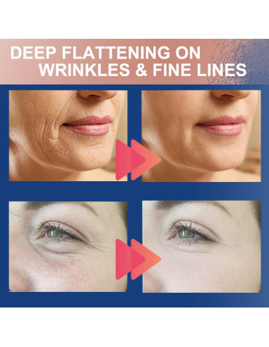 Cinta Kinesiológica Facial Akissos 2.5cm x 5m - Antiarrugas