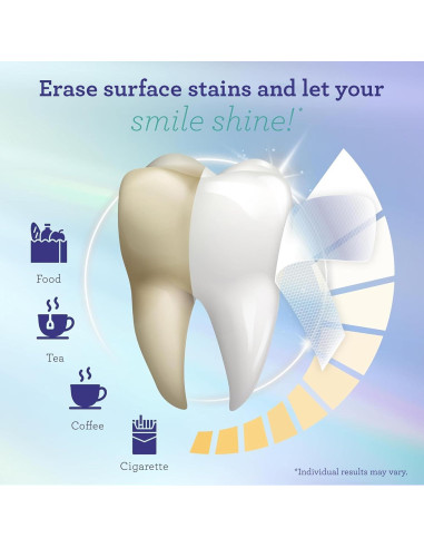 Tiras Blanqueadoras GuruNanda - 7 Tratamientos Efectivos