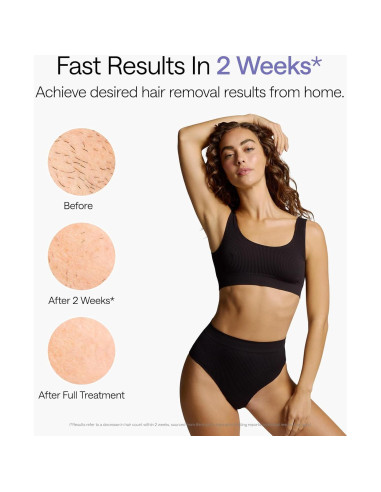 Ulike Depilación Láser Air 10 IPL para Mujeres y Hombres