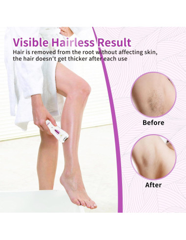 Epilador Facial Portátil Lyndops KD190R con Luz LED