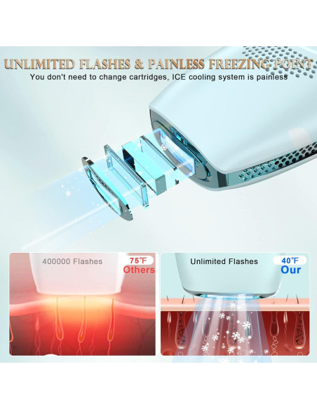 DEESS Removedor de Vello IPL GP590 con Enfriamiento Indoloro