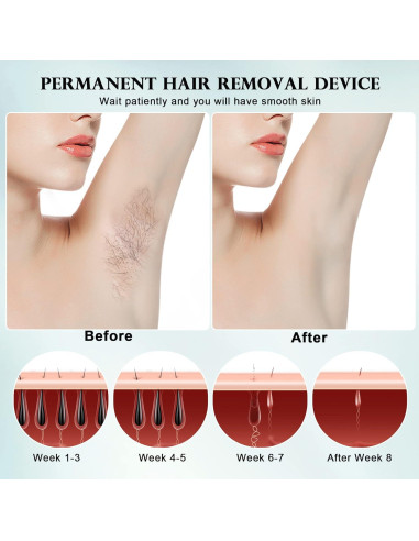 DEESS Removedor de Vello IPL GP590 con Enfriamiento Indoloro