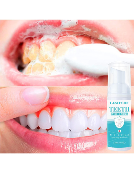 Espuma Blanqueadora Dental LANTHOME 3PCS Efecto Múltiple