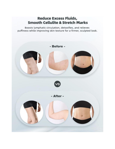 Masajeador Drenaje Linfático Yuonry G05 Anticelulitis