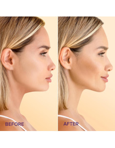 Máscara Elevadora V MAREE con Oro 24K - 5 Unidades 2