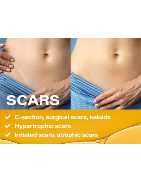 Aceite de Masaje Anticelulitis Sonuka 250 ml Drenaje Linfático