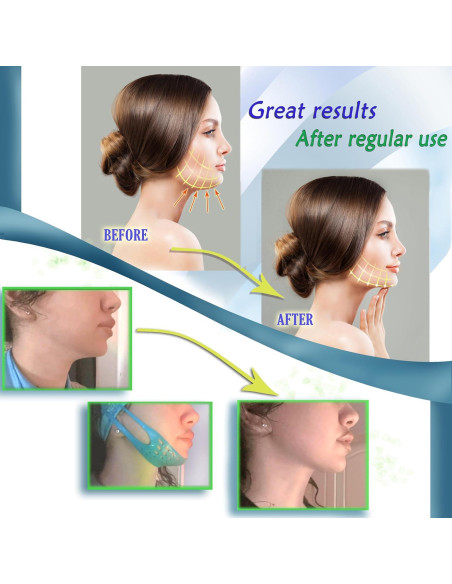 Correa Facial Reutilizable BYONDO para Doble Papada - TPE Suave