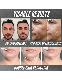 JawBlocks Ejercitador de Mandíbula JAWTONE Kit 4 Piezas 2