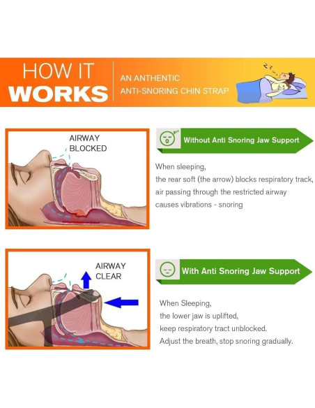 Correa Antisnoring Glotao Modelo 2025 Ajustable para Dormir