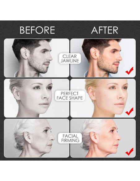 Alpha Jaw Entrenador Facial 3.0 - Ejercitador de Mandíbula 6 PCS