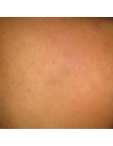 Aceite Natural para Remoción de Tatuajes ATAMAZE 40g