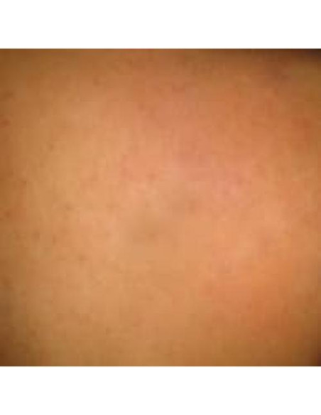 Aceite Natural para Remoción de Tatuajes ATAMAZE 40g