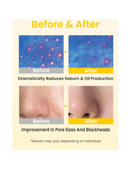 Aceite Limpiador Facial Elvira Pore Control 140g - Piel Sensible Aceite Limpiador Facial Elvira Pore Control 140g - Piel Sensible