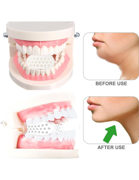 Ejercitador de Mandíbula Jowxsx - Silicona BPA, Resistencia