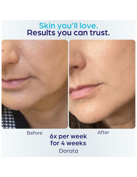 Máscara Facial LED Terapia de Luz Roja y Azul Ambicare PR7001US