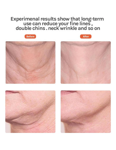 Masajeador Facial Ms.W Luz Roja y Vibración para Piel