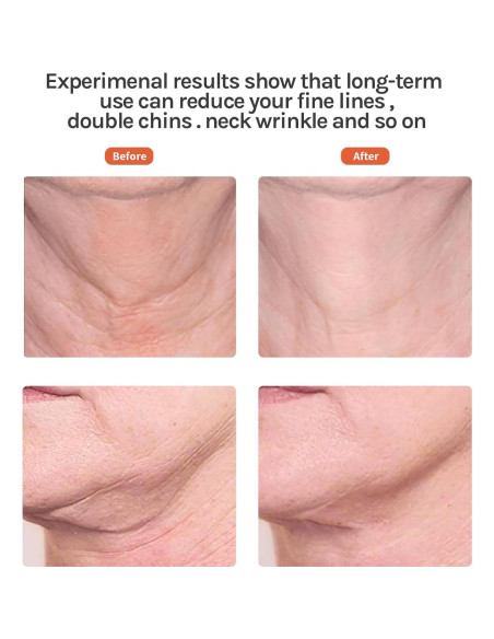 Masajeador Facial Ms.W Luz Roja y Vibración para Piel