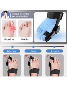 Corrector de Juanetes HUQKIYA Ajustable para Pies Izquierdo/Derecho 2