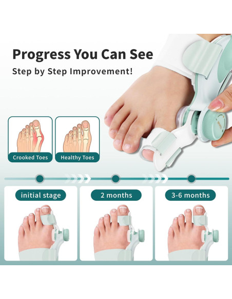 Corrector de Juanetes EliaValth 2 PCS Ajustable Mediana