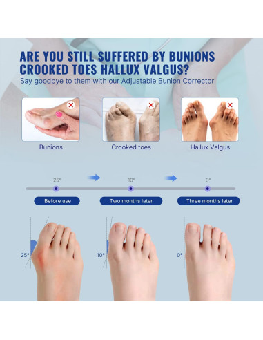 Corrector de Juanetes Fit Geno Unisex Ajustable 2 Pcs