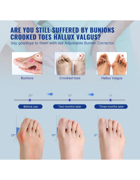 Corrector de Juanetes Fit Geno Unisex Ajustable 2 Pcs