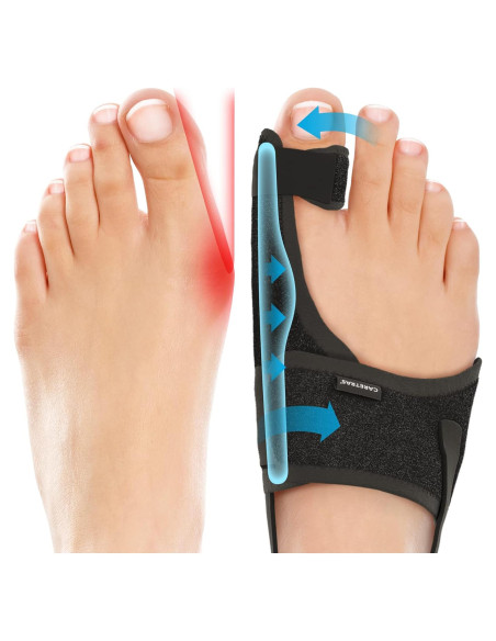 Corrector de Juanetes Caretras Unisex Ajustable 17.5x13.2cm