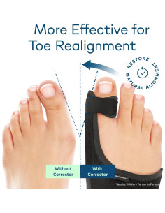 Corrector de Juanetes Caretras Unisex Ajustable 17.5x13.2cm 2