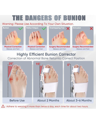 Corrector de Juanetes Ecqizer Ajustable para Dedo Gordo