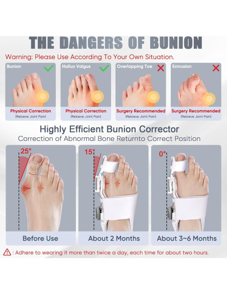 Corrector de Juanetes Ecqizer Ajustable para Dedo Gordo