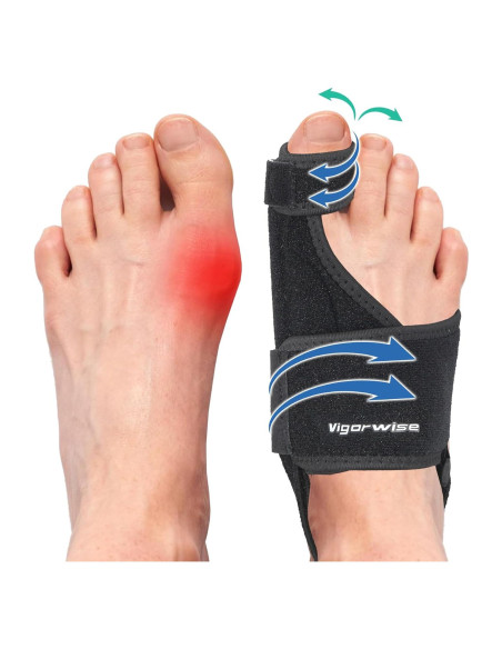 Corrector de Juanetes Vigorwise 2 Piezas Aluminio Ajustable