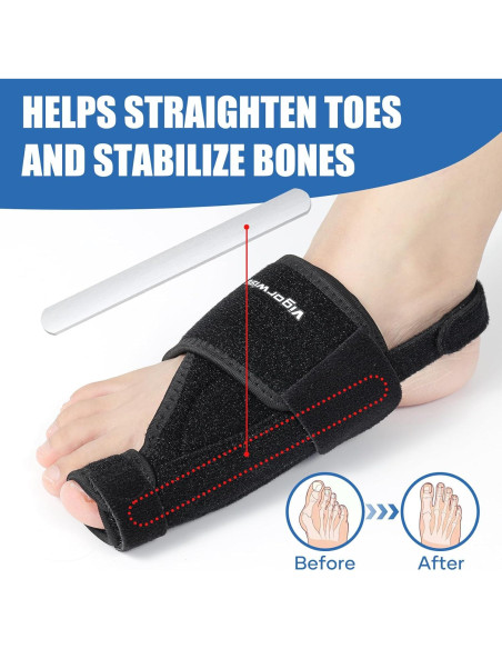 Corrector de Juanetes Vigorwise 2 Piezas Aluminio Ajustable