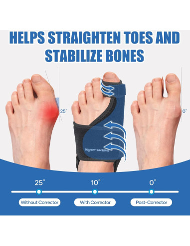 Corrector de Juanetes Vigorwise 2 Piezas Aluminio Ajustable