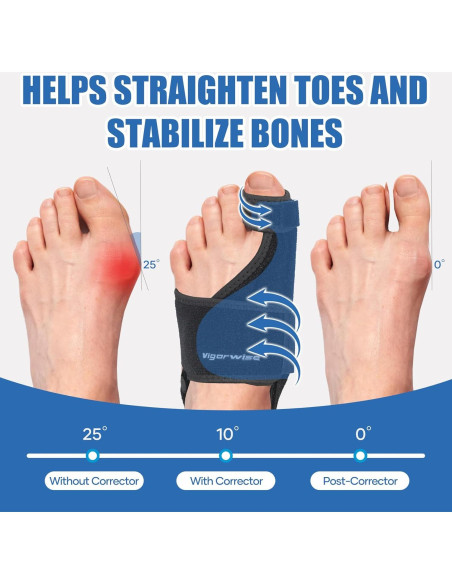 Corrector de Juanetes Vigorwise 2 Piezas Aluminio Ajustable