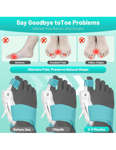 Corrector de Juanetes QDAVE Ajustable para Hombres y Mujeres