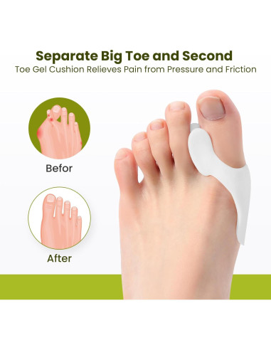 Protector de Almohadilla para Juanetes Bukihome - 8 Pzas Gel