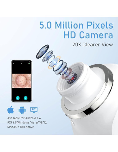 Aspiradora de Puntos Negros Ottleba H200 USB 3 Modos 6 Cabezales