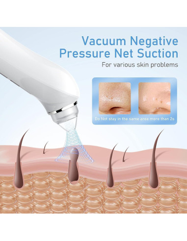 Aspiradora de Puntos Negros Ottleba H200 USB 3 Modos 6 Cabezales