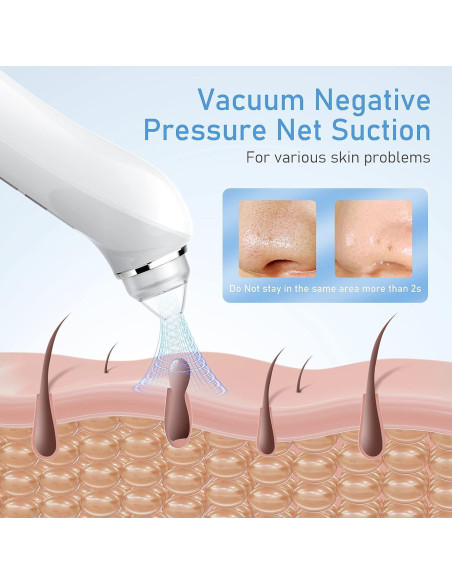 Aspiradora de Puntos Negros Ottleba H200 USB 3 Modos 6 Cabezales Aspiradora de Puntos Negros Ottleba H200 USB 3 Modos 6 Cabezales