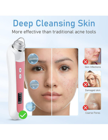 Aspiradora de Puntos Negros Ottleba H200 USB 3 Modos 6 Cabezales