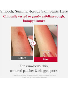 Spray Exfoliante Corporal Medicube Red Peeling 110g AHA BHA 2