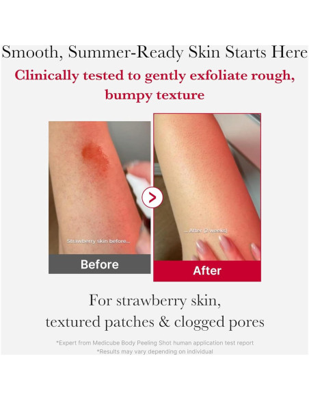 Spray Exfoliante Corporal Medicube Red Peeling 110g AHA BHA