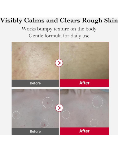 Spray Exfoliante Corporal Medicube Red Peeling 110g AHA BHA