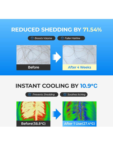 Suero Crecimiento Cabello Scalpy 19.84 ml - No Graso