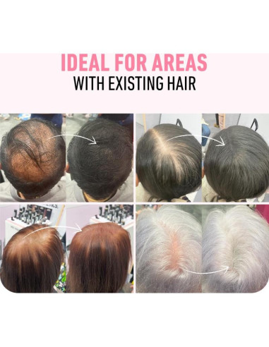 Fibras para Cabello Boldify 28g - Marrón Oscuro - Relleno Instantáneo