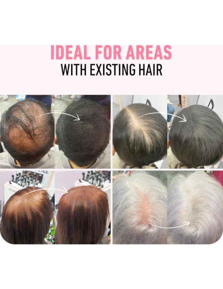 Fibras para Cabello Boldify 28g - Marrón Oscuro - Relleno Instantáneo