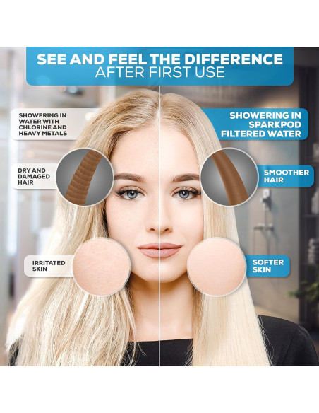Cabezal de Ducha Filtrado SparkPod 23 Etapas Alta Presión
