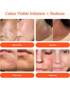 Spray Facial SOS Tower 28 para Piel Sensible 118 ml 2